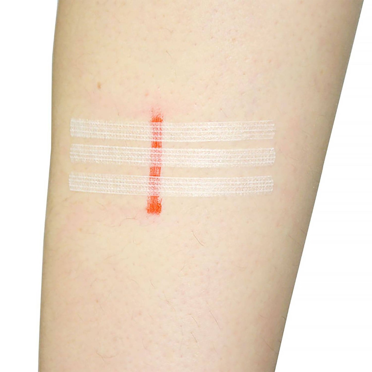 Teqler 3mm x 75 mm Vlinder Hechtingen Verpakking van 10