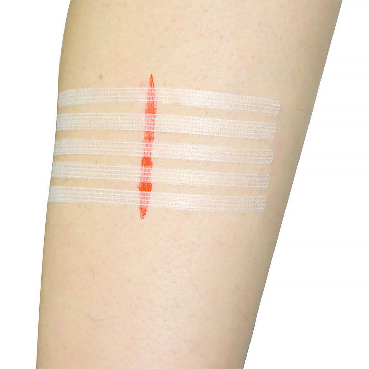 Teqler 6mm x 100mm Vlindersteken Verpakking 10